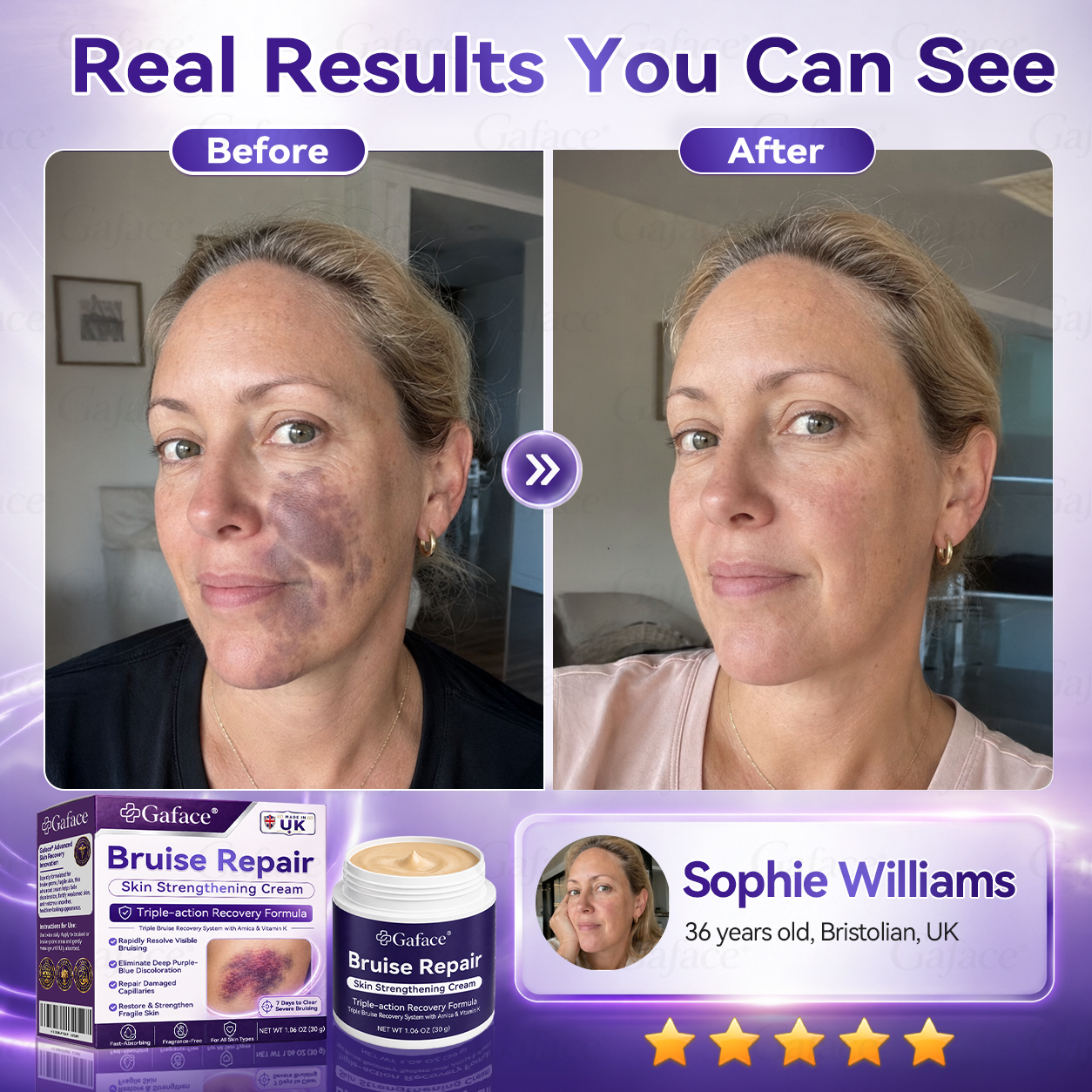 𝑮𝒂𝒇𝒂𝒄𝒆®🛡️👩‍⚕️ 𝑩𝒓𝒖𝒊𝒔𝒆 𝑹𝒆𝒑𝒂𝒊𝒓 & 𝑺𝒌𝒊𝒏-𝑺𝒕𝒓𝒆𝒏𝒈𝒕𝒉𝒆𝒏𝒊𝒏𝒈 𝑪𝒓𝒆𝒂𝒎