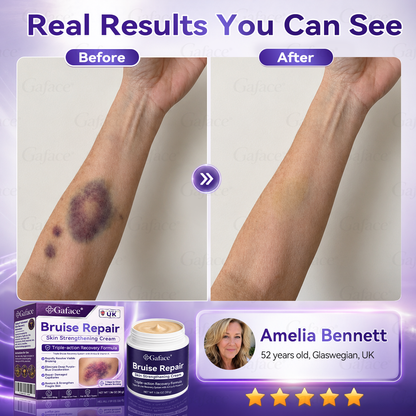 𝑮𝒂𝒇𝒂𝒄𝒆®🛡️👩‍⚕️ 𝑩𝒓𝒖𝒊𝒔𝒆 𝑹𝒆𝒑𝒂𝒊𝒓 & 𝑺𝒌𝒊𝒏-𝑺𝒕𝒓𝒆𝒏𝒈𝒕𝒉𝒆𝒏𝒊𝒏𝒈 𝑪𝒓𝒆𝒂𝒎