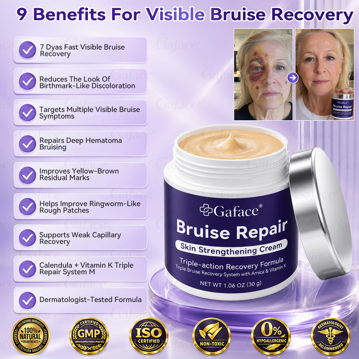 𝑮𝒂𝒇𝒂𝒄𝒆®🛡️👩‍⚕️ 𝑩𝒓𝒖𝒊𝒔𝒆 𝑹𝒆𝒑𝒂𝒊𝒓 & 𝑺𝒌𝒊𝒏-𝑺𝒕𝒓𝒆𝒏𝒈𝒕𝒉𝒆𝒏𝒊𝒏𝒈 𝑪𝒓𝒆𝒂𝒎