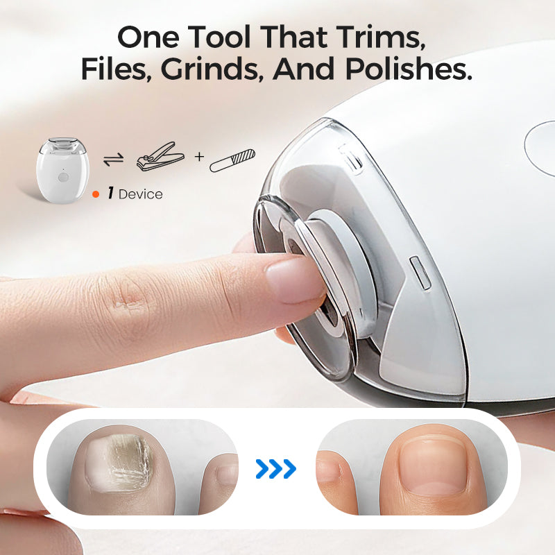 ✨New Year Special: 50% Off ✨ Multifunction Automatic Nail Trimmer – 6 Speed Levels, Safe and Gentle for Easy Nail Care 💅
