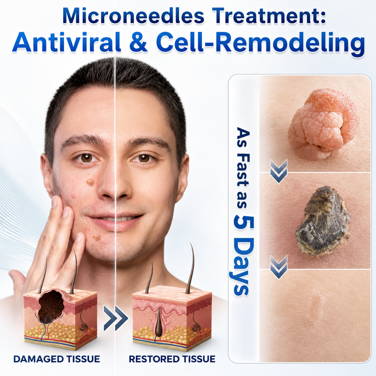 👩‍⚕️🎁 𝐎𝐟𝐟𝐢𝐜𝐢𝐚𝐥 𝐒𝐭𝐨𝐫𝐞 | 𝑵𝐞𝒌𝐢𝐬𝐬® 🌿 𝐁𝐨𝐭𝐚𝐧𝐢𝐜𝐚𝐥 𝐌𝐢𝐜𝐫𝐨𝐧𝐞𝐞𝐝𝐥𝐞 𝐇𝐲𝐝𝐫𝐨𝐜𝐨𝐥𝐥𝐨𝐢𝐝 𝐏𝐚𝐭𝐜𝐡 (𝐅𝐨𝐫 𝐒𝐤𝐢𝐧 𝐓𝐚𝐠𝐬, 𝐒𝐦𝐚𝐥𝐥 𝐒𝐤𝐢𝐧 𝐆𝐫𝐨𝐰𝐭𝐡𝐬, 𝐖𝐚𝐫𝐭𝐬, 𝐌𝐨𝐥𝐞𝐬, 𝐀𝐠𝐞 𝐒𝐩𝐨𝐭𝐬 & 𝐏𝐢𝐠𝐦𝐞𝐧𝐭𝐚𝐭𝐢𝐨𝐧 𝐂𝐨𝐧𝐜𝐞𝐫𝐧𝐬)